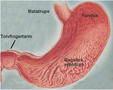 Ventricel_72.jpg Ventricel_72.jpg
